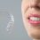 Clear Dental Aligner Options Such as Invisalign Can Give You a Gorgeous Smile